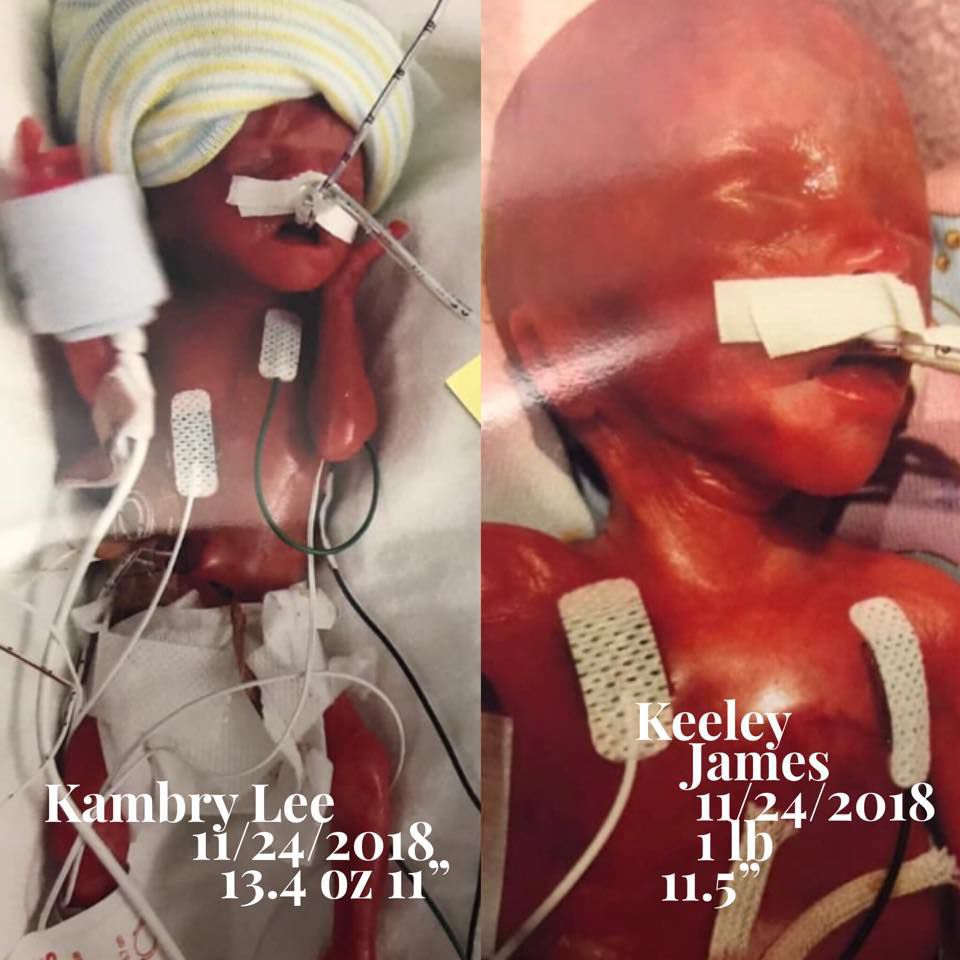 Twins at birth